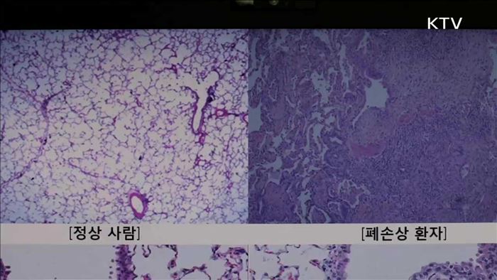 모든 '살생물질' 승인 받아야…안전관리 법제화 추진