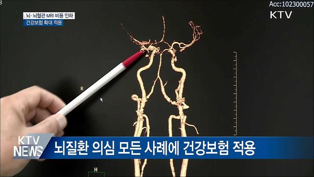 내일부터 뇌·뇌혈관 MRI 비용 대폭 인하