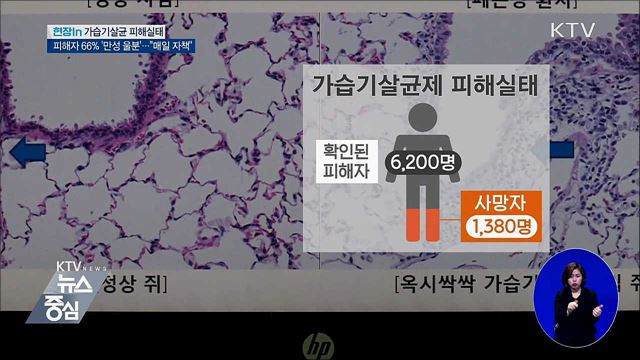 가습기살균제 피해자 66% '만성 울분'···"매일 자책" [현장in]