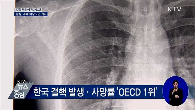 결핵 환자, 남성·70대 이상 노인 가장 많아