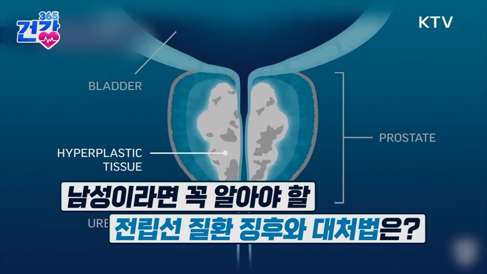 건강 365 (32회)