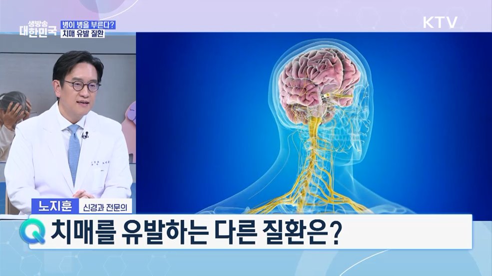 과거와 미래를 잃는 병 치매 예방·극복은? [건강 365]