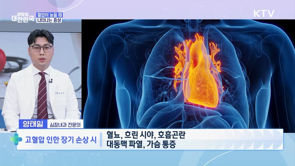 침묵의 살인자 고혈압 극복·예방법 [건강365]