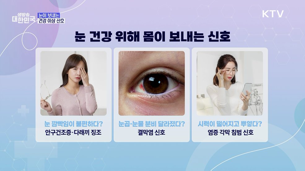 가렵고 따갑고 충혈되는 눈! 봄철 눈 건강 관리법 [건강 365]