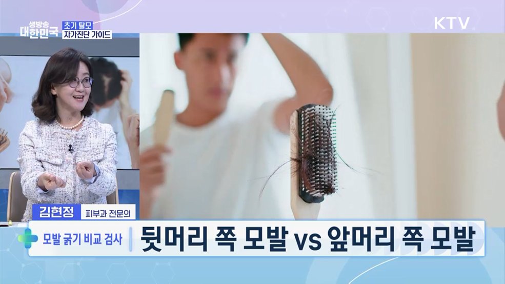 "탈모, 생존의 문제" 탈모 극복 프로젝트 [건강365]