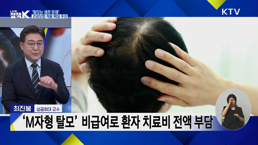 유전 질환과 질병의 경계···탈모 건강보험 확대 논의는?