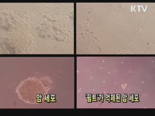 국내연구진, 새로운 암 억제법 발견