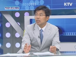 백내장의 원인과 예방법 [건강365]