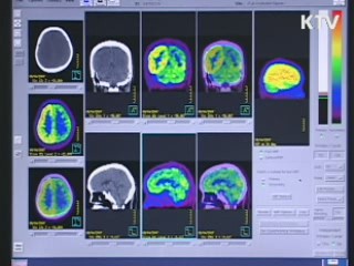경남도, 저소득층 뇌질환 MRI 무료 검진 실시