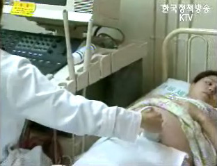 ‘불임부부 지원사업’에 대해서