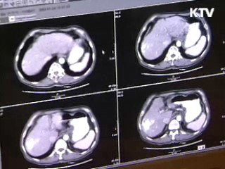 척추·관절질환 MRI 건강보험 적용